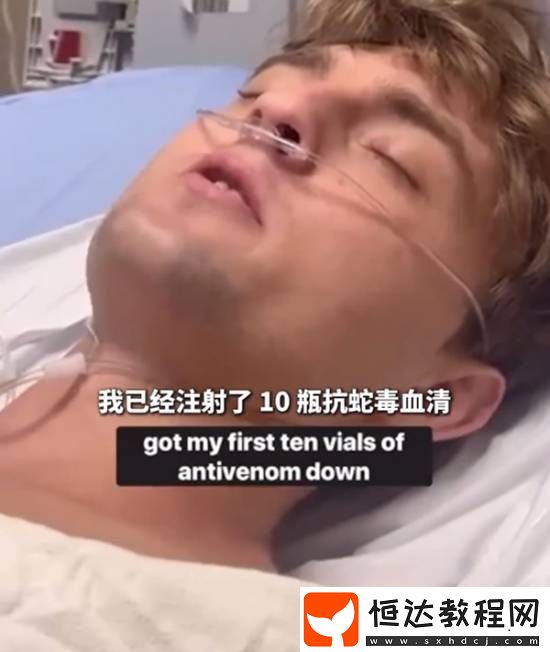 美國25歲網(wǎng)紅被響尾蛇咬傷后先拍視頻