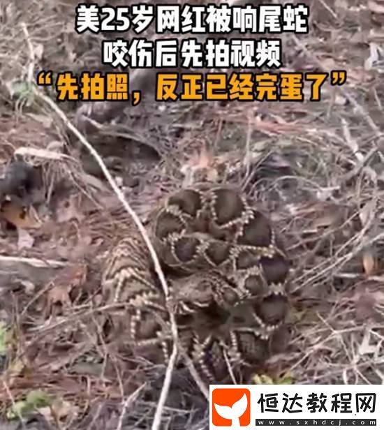 美國25歲網(wǎng)紅被響尾蛇咬傷后先拍視頻